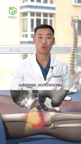 19K views · 124 reactions | ... Autologous stem cell therapy ... 溺...