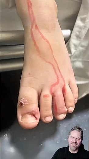 From a #wound to an #emergency - Specialist Doctors