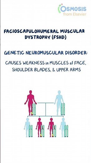What Causes Fascioscapulohumeral Muscular Dystrophy?