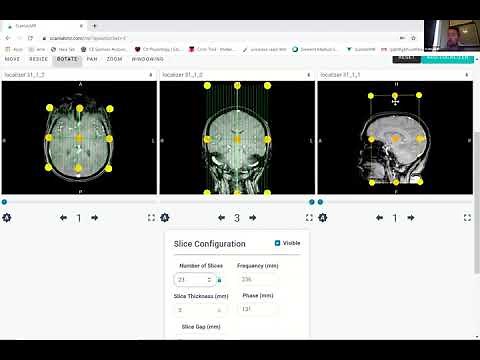 ScanLabMR - How to Use Our Platform