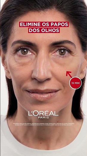 Adeus papos! Novo Revitalift Laser Corretor Instantâneo | L’Oréal Paris