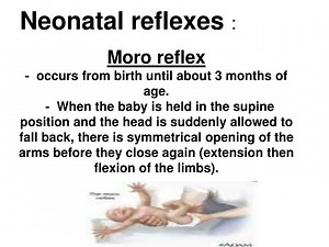 PPT - Neonatal reflexes : PowerPoint Presentation, free download - ID:358569