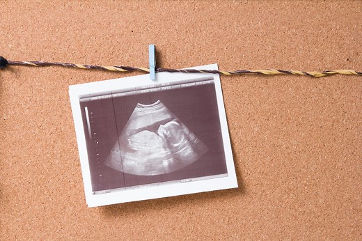 Indemnités journalières maternité : calcul et montant des IJ SS