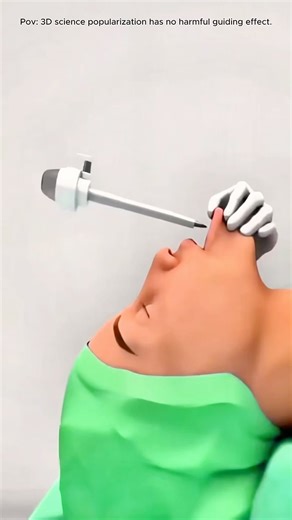 Thyroidectomy Surgery (3D Animation)#thyroid#surgery#neck#anesthesia#3danimation