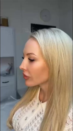 ✨ THE BARBIE DOLL SNATCHED LOOK ✨ Face Threads | Lips | Skin Booster | Tox The ultimate glow-up package 💉💋 Our beautiful client wanted that lifted, sculpted, soft glam Barbie finish — and look at the results… ✔️ Snatched jawline with face threads ✔️ Perfectly balanced, plump lips ✔️ Glass-skin glow with skin booster ✔️ Smooth, lifted finish with tox The result? Defined. Feminine. Youthful. Snatched. How beautiful does our client look 😍 At Cheree Leon Aesthetics, we pride ourselves on 5⭐ custo