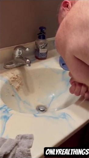 Giant Pimple Exploding #crazy #nasty