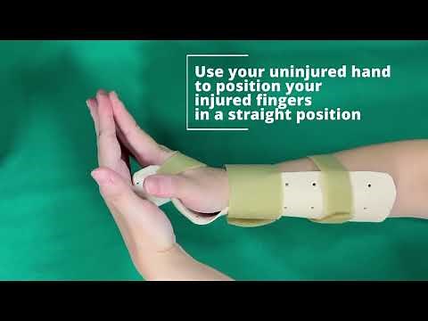 Exercises to Improve Hand Mobility — Extensor Tendon Injury | SKH Occupational Therapy