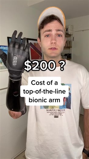 Advanced Bionic Arm Technology and Prosthetic Innovations