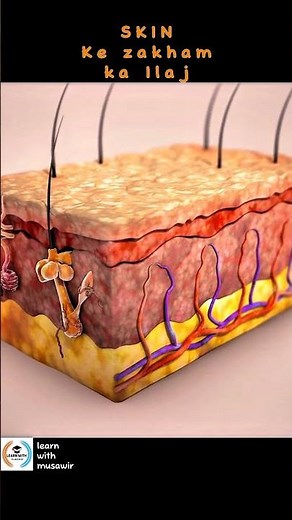 SKIN WOUND HEALING PROCESS || SKIN Ka Ilaj ||