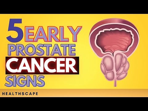 5 Early Prostate Cancer Signs You Should Not IGNORE!!