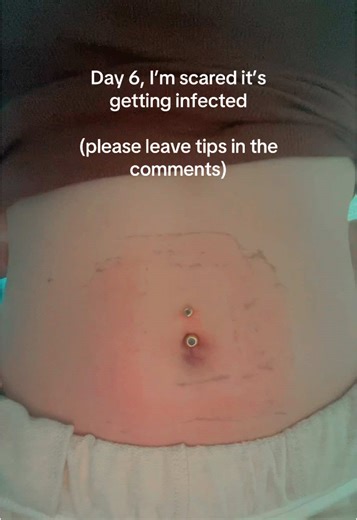 Navel Piercing Care Tips: Avoiding Infection