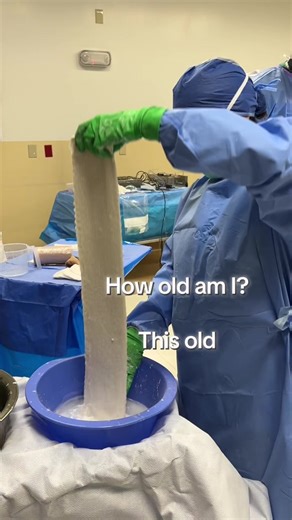 Plaster over fiber for splints #orthopedics #plaster #cast | plaster cast