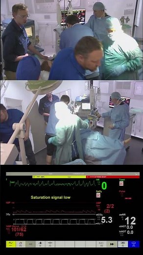 Cardiac Arrest in Theatre – Intraoperative Emergency Simulation