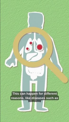 What It Means to Be Immunocompromised