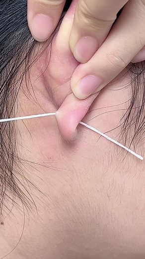 Easy and Safe Pierced Ear Cleaning Tips