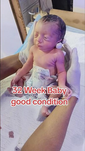 "32-Week Preemie Received in NICU – Stable and Strong Start"