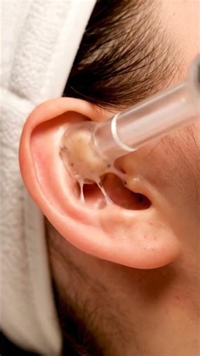 Macro Temple Pore Cleaning | Satisfying ASMR Skincare #asmr #skincare