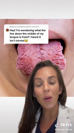 Dealing with Fissured Tongue: Causes and Solutions