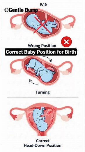 Baby Position in Womb Explained 🤰 | Wrong vs Correct Birth Position