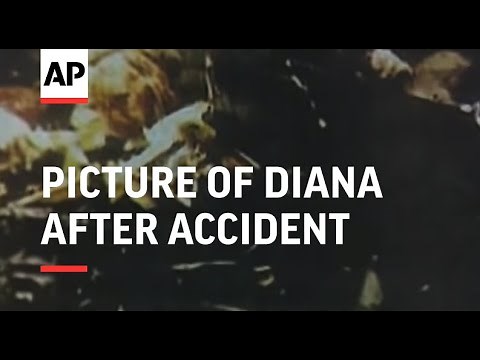 France - Picture of Diana after accident