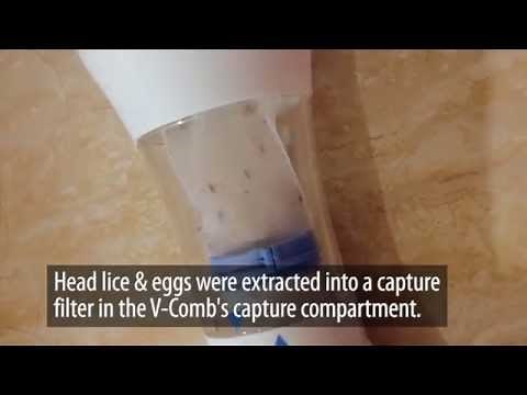 How to combat Head lice using LiceTec V-Comb