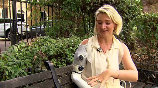 London mother shows off groundbreaking bionic arm
