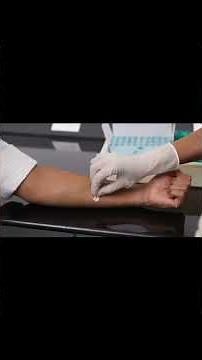 Cy-Tb skin test | administration and measurement