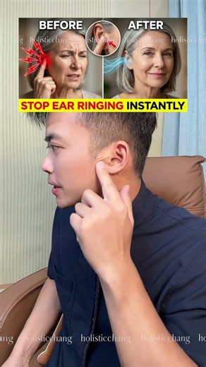Stop Ringing Ears Instantly with This #TinnitusRelief #EarHealth #HealthTips