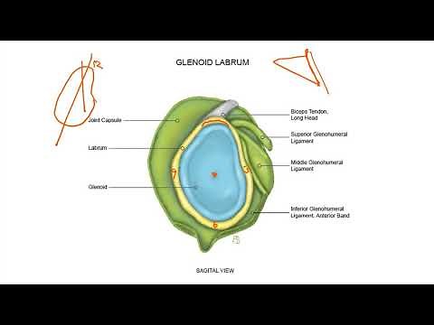 SLAP Lesions - Snyder Classification System