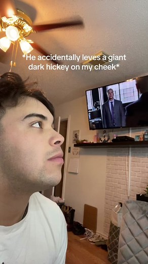 Dealing with a Dark Hickey: Stress, Cover-Up, and Frustration