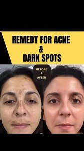 4.7K views · 8 comments | Natural Beauty Tips on Reels | Facebook