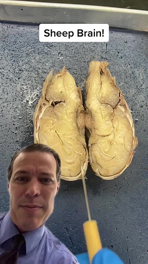 Sheep Brain Dissection: Exploring Gray and White Matter