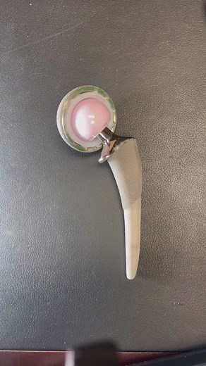 Understanding Tuttle Hip Replacement and Components