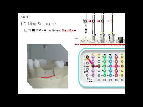 485 KIT Drilling Sequence