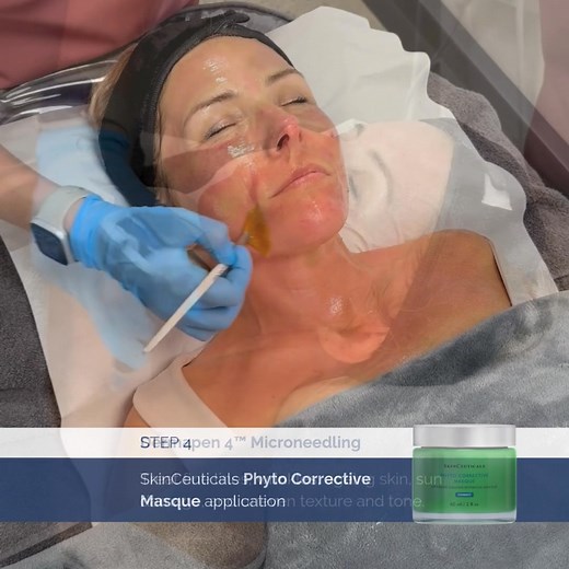 Dermapen 4™ creates micro-channels to stimulate collagen, while NeoStrata’s medical-grade peels exfoliate and deeply renew the skin. Also included: medical-grade numbing, Mesoestetic actives, a SkinCeuticals mask, and LED therapy—giving you a complete age-defying transformation.  Available exclusively at Natural Aesthetics in Green Point, Tyger Valley, and Somerset West. Book now to transform your skin! | Natural Aesthetics - Skincare Clinics | Facebook