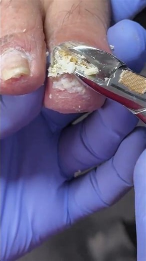 Satisfying Pedicure Video! #pedicure #toenails