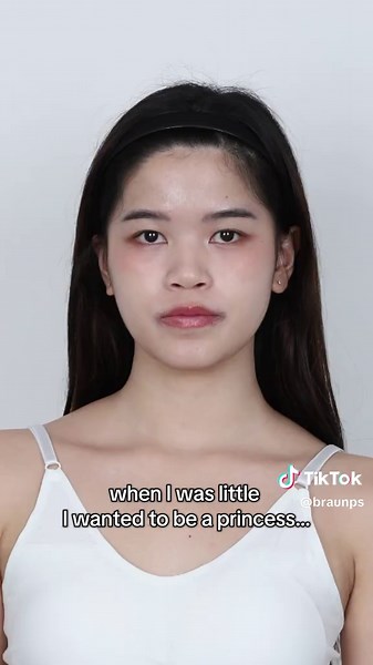 Transforming Into a Princess: My Nose Journey