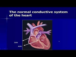 Basics of an EP study Dr Ayman Mortada - 2-10-2019