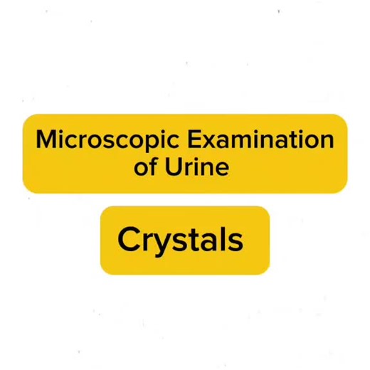 Microscopic Examination of Urine Crystals