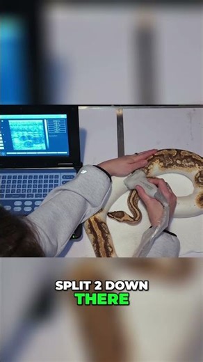 Counting Potential Eggs Finding 11 Follicles!