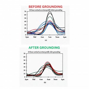 😴 Get your best sleep ever! Proven by 20 clinical studies & loved by over a million customers worldwide. Fall asleep faster, deeper and wake up refreshed - reduced pain too! Try now for better brain function in one night's rest | Grounding Mat