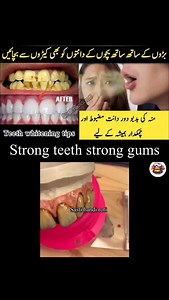 136 reactions | Teeth Whitening Remedy | Teeth Whitening Formula #diy #teethcare #teeth #homeremedy #beauty #trending #viral #reelvideo | Sasti Handi Roti | Facebook