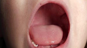 Close-up Child Mouth Baby Teeth Deciduous Stock Footage Video (100% Royalty-free) 1088757215 | Shutterstock