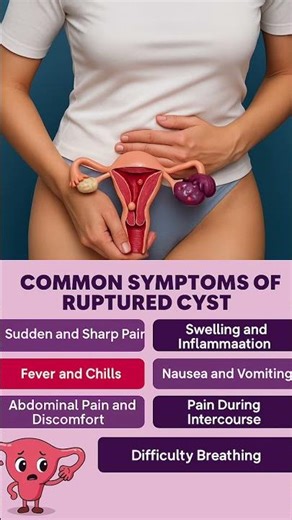 Ruptured ovarian cyst : signs and symptoms . #ovariancysts .