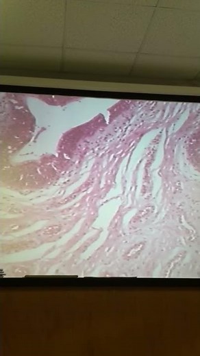 Corpus spongiosum and cavernosa