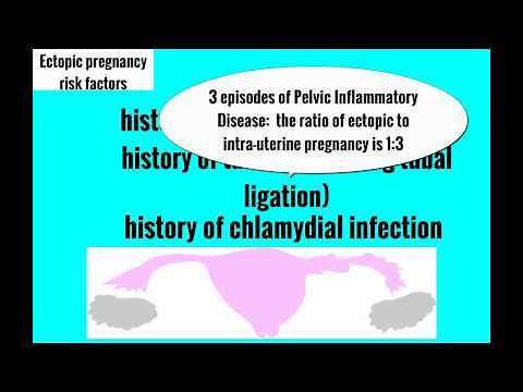Topic 15: Ectopic Pregnancy