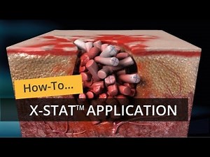 X-Stat