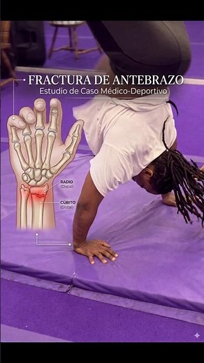 💥 FRACTURA de Antebrazo: Por qué ocurre y cómo EVITARLA #lesionesdeportivas #deporte #accidente