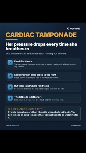CARDIAC TAMPONADE