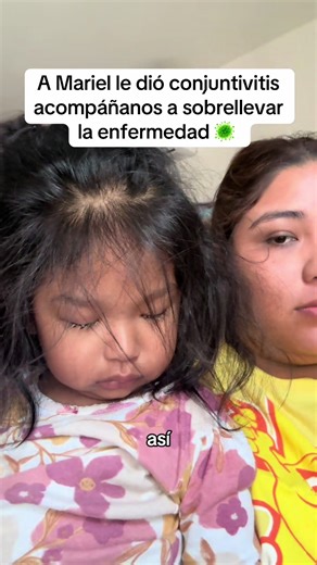 A Mariel le dió conjuntivitis 🦠😰#amadecasa #mommyvlogger #conjuntivitisalergica #familia #mamaprimeriza
